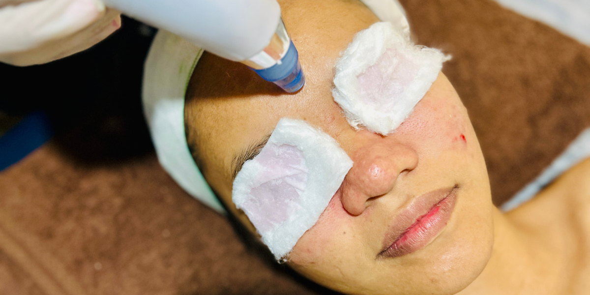 Facial Facial