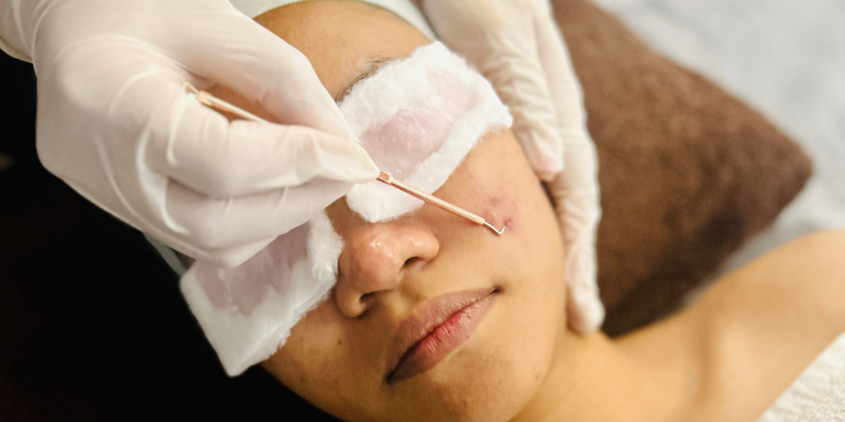 Revitalise Your Skin With Hydrafacial Near Me